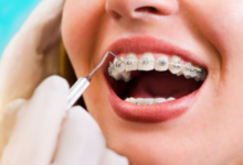 Tollgate Orthodontics: Transforming Smiles Across Warwick and Jamestown, RI