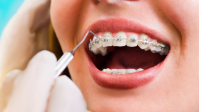 Tollgate Orthodontics: Transforming Smiles Across Warwick and Jamestown, RI