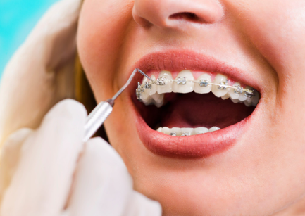 Tollgate Orthodontics: Transforming Smiles Across Warwick and Jamestown, RI